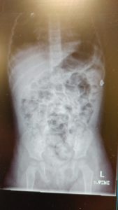 X-ray #2